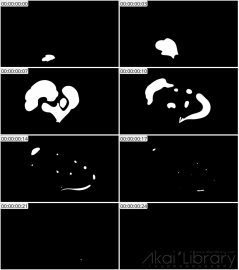 AE模板 手绘卡通烟雾 Hand Drawn Cartoon Smoke | After Effects 04