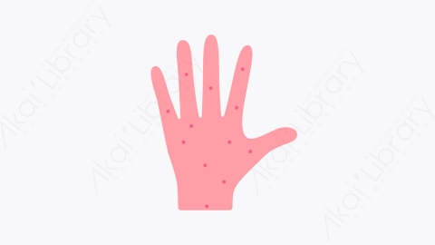 图片素材-006皮肤过敏 skin allergy扁平MG卡通空气污染元素图标