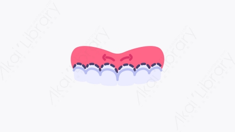 图片素材-017牙科手术 dental surgery扁平MG卡通牙科元素图标