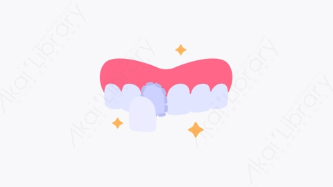 图片素材-029牙贴面 dental veneer扁平MG卡通牙科元素图标