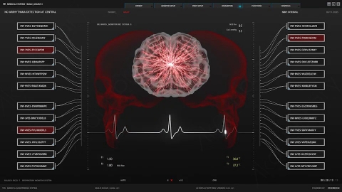 AE模板-01_Medical Display_09大脑医疗分析扫描HUD科技界面.zip