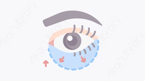 图片素材-005眼袋 eye bagsMG卡通整形外科元素图标