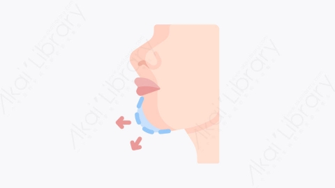 图片素材-012例 mentoplastyMG卡通整形外科元素图标