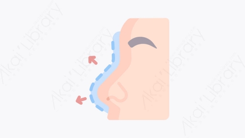 图片素材-013隆鼻 rhinoplastyMG卡通整形外科元素图标