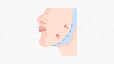 图片素材-014颌骨轮廓 jaw contouringMG卡通整形外科元素图标