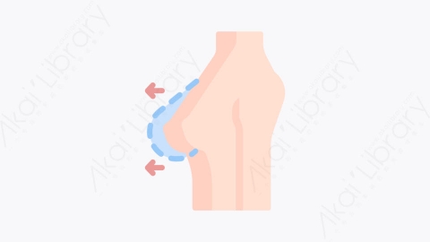 图片素材-016乳房植入物 breast implantMG卡通整形外科元素图标