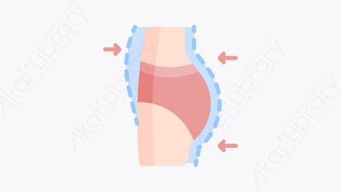 图片素材-022吸脂 liposuctionMG卡通整形外科元素图标