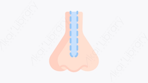 图片素材-026隆鼻 rhinoplastyMG卡通整形外科元素图标
